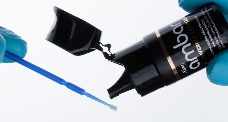 Caso 17 23 - Substituição de facetas em resina composta associada à otimização do substrato por meio de clareamento dental 24 | Aplicação do adesivo Ambar Universal APS Plus.