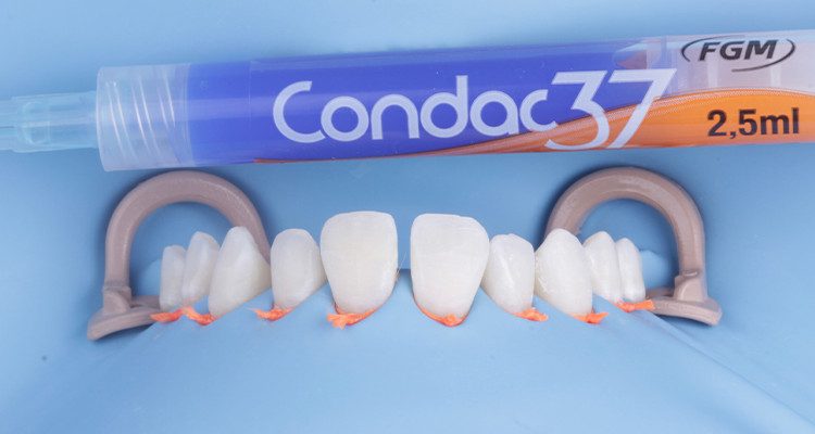 22 e 23 | Condicionamento com ácido 37% Condac 37