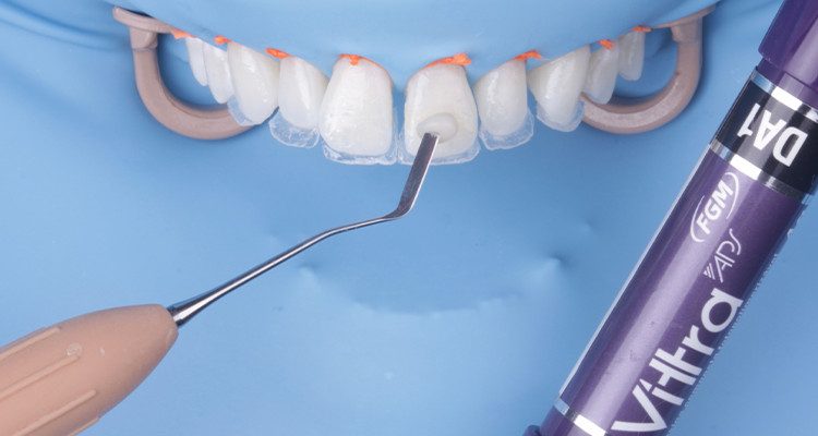 29 | Aplicação de dentina Vittra APS DA1.