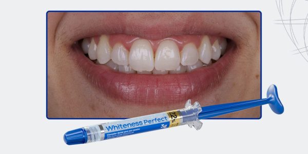 02_Capa-Clareamento-Caseiro-Supervisionado-Com-Whiteness-Perfect-22%