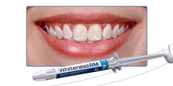 04_Capa-Transformacao-conservadora-do-sorriso-com-clareamento-dental-e-microabrasao