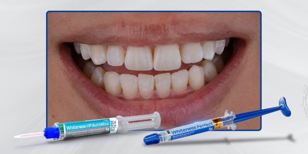 Caso-1_Capa-Clareamento-dental-com-técnica-associada-consultório-e-caseiro-supervisionado