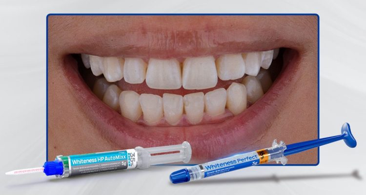 Caso-1_Capa-Clareamento-dental-com-técnica-associada-consultório-e-caseiro-supervisionado