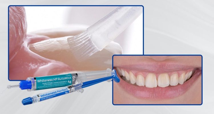 Caso-2_Capa-Técnica-associada-de-clareamento-dental-eficácia-e-ausência-de-sensibilidade