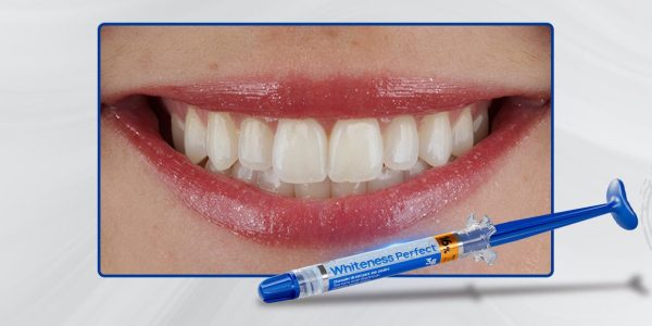 Materia-3_Capa-Clareamento-dental-pela-técnica-caseira-praticidade,-segurança-e-eficácia-comprovadas