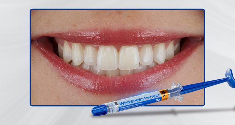 Materia-3_Capa-Clareamento-dental-pela-técnica-caseira-praticidade,-segurança-e-eficácia-comprovadas
